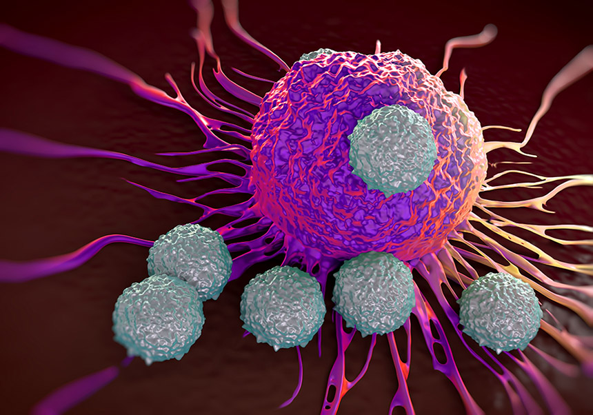 CAR-T Cell Therapy